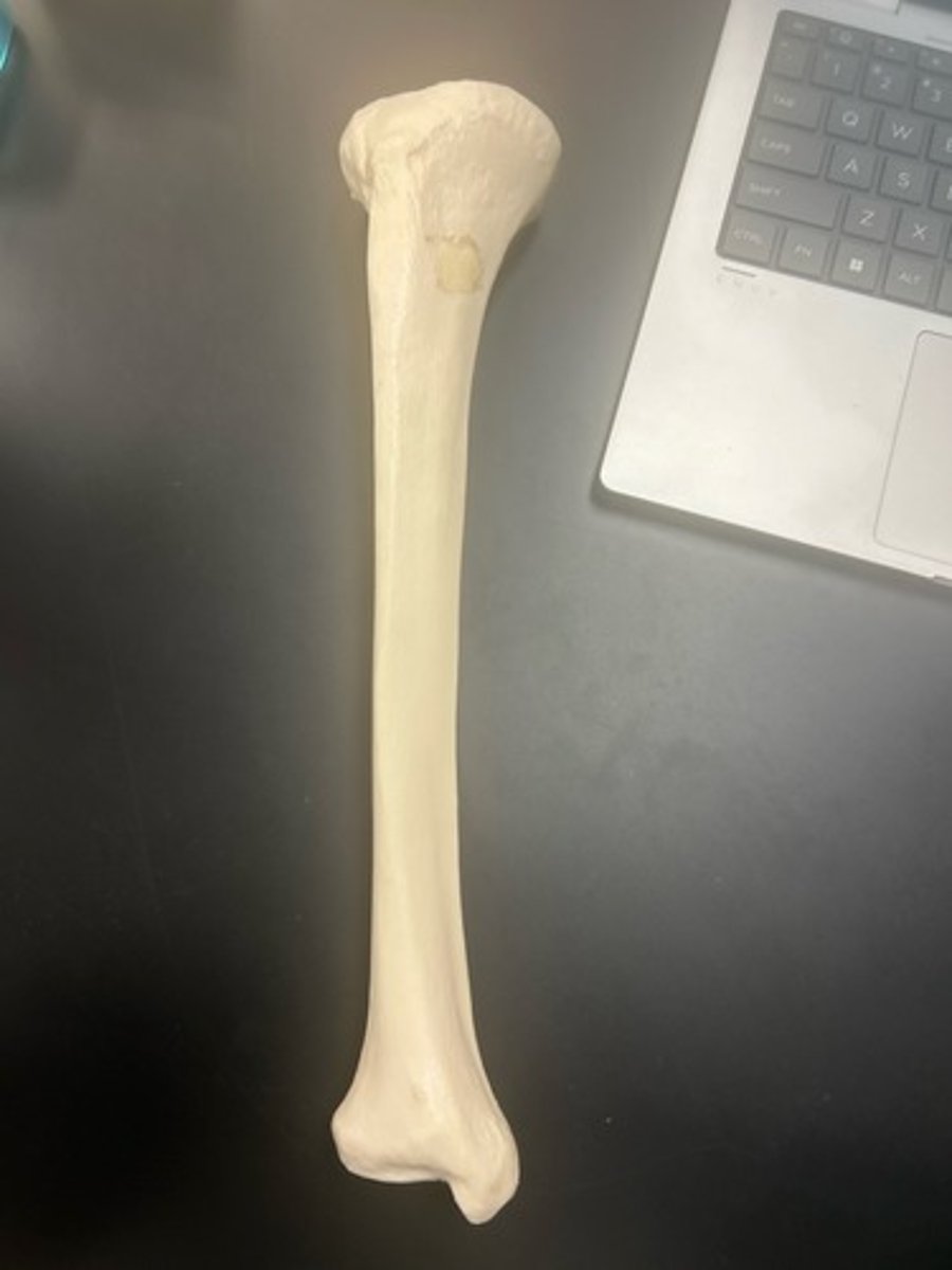 <p>name the bone</p>