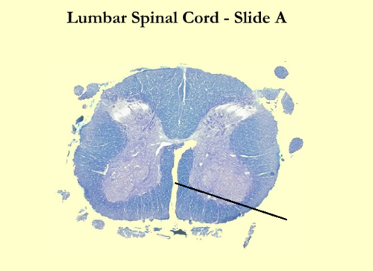 <p>What is the midline structure that separates the ventral left and right halves of the white matter</p>