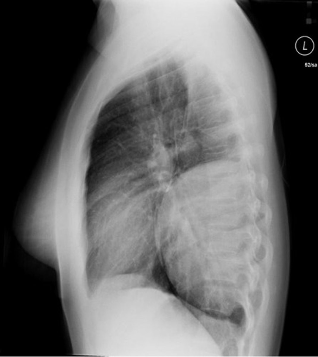 <p>home of tumors of neural origin</p>