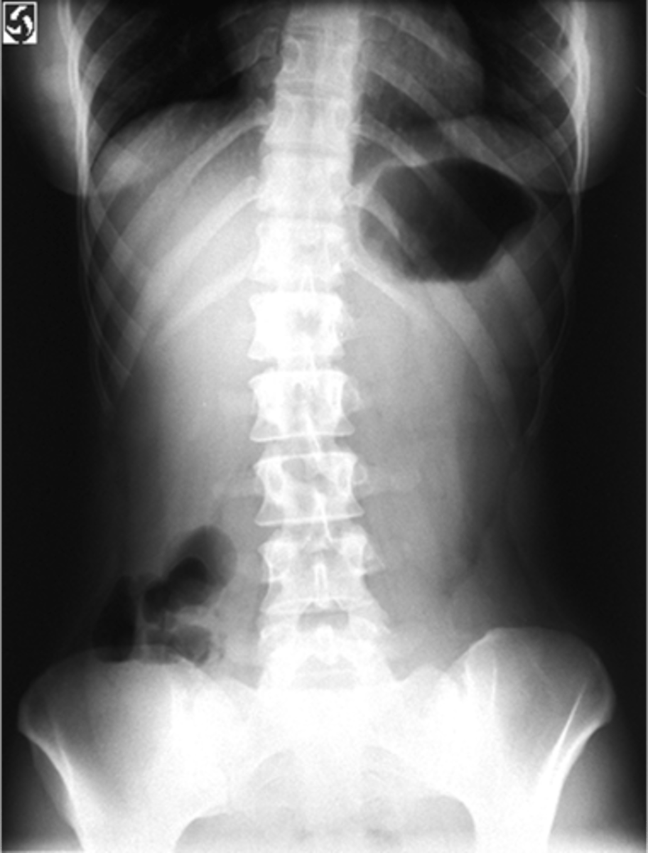 <p>What position is the patient in?</p>