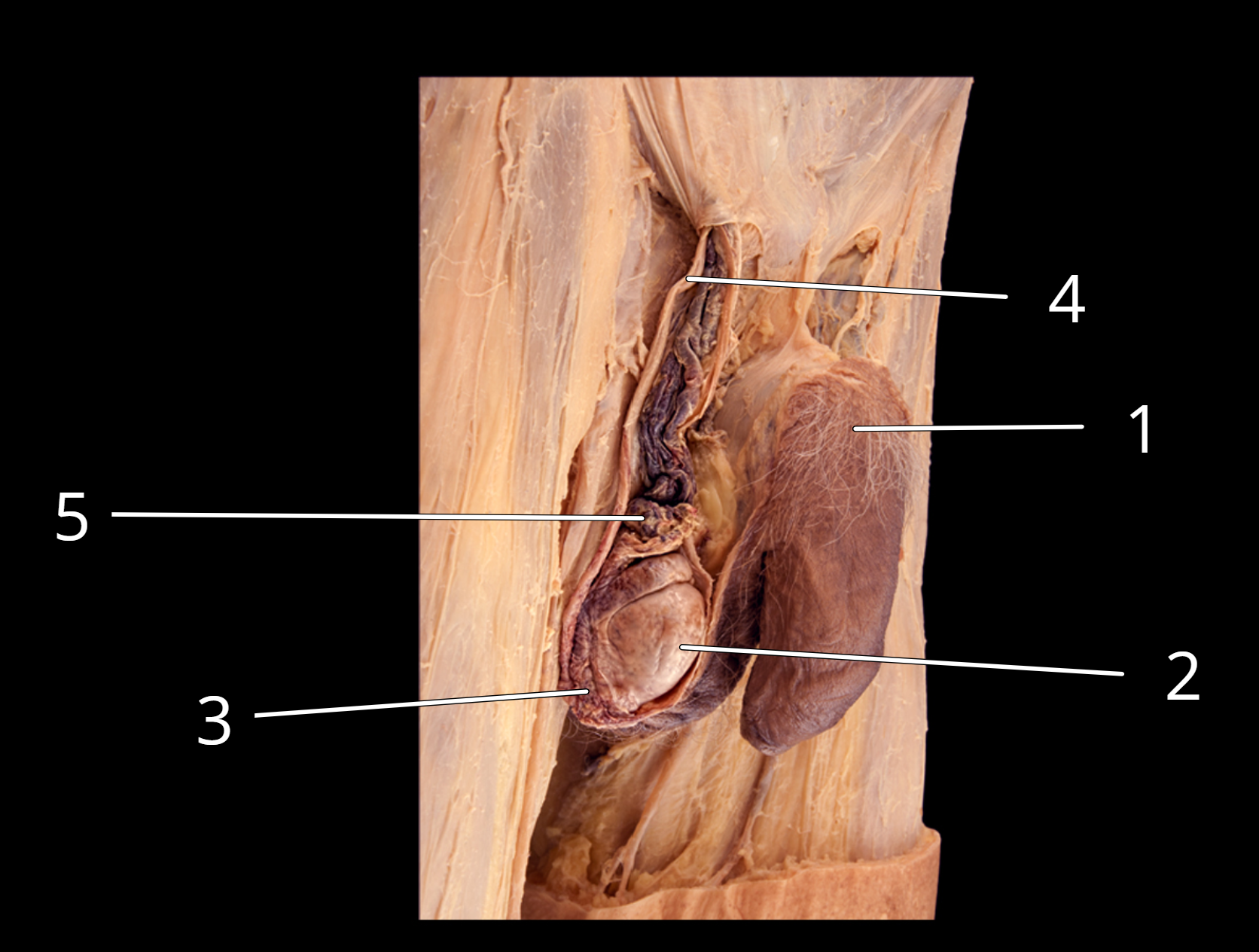 <p>Penis and testis, lateral view </p>