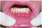 <ul><li><p>Epithelium is not generally keratinized</p></li><li><p>Tissues not firmly attached</p></li><li><p>Covers inner surface of lips, cheeks, floor of mouth</p></li></ul><p></p>