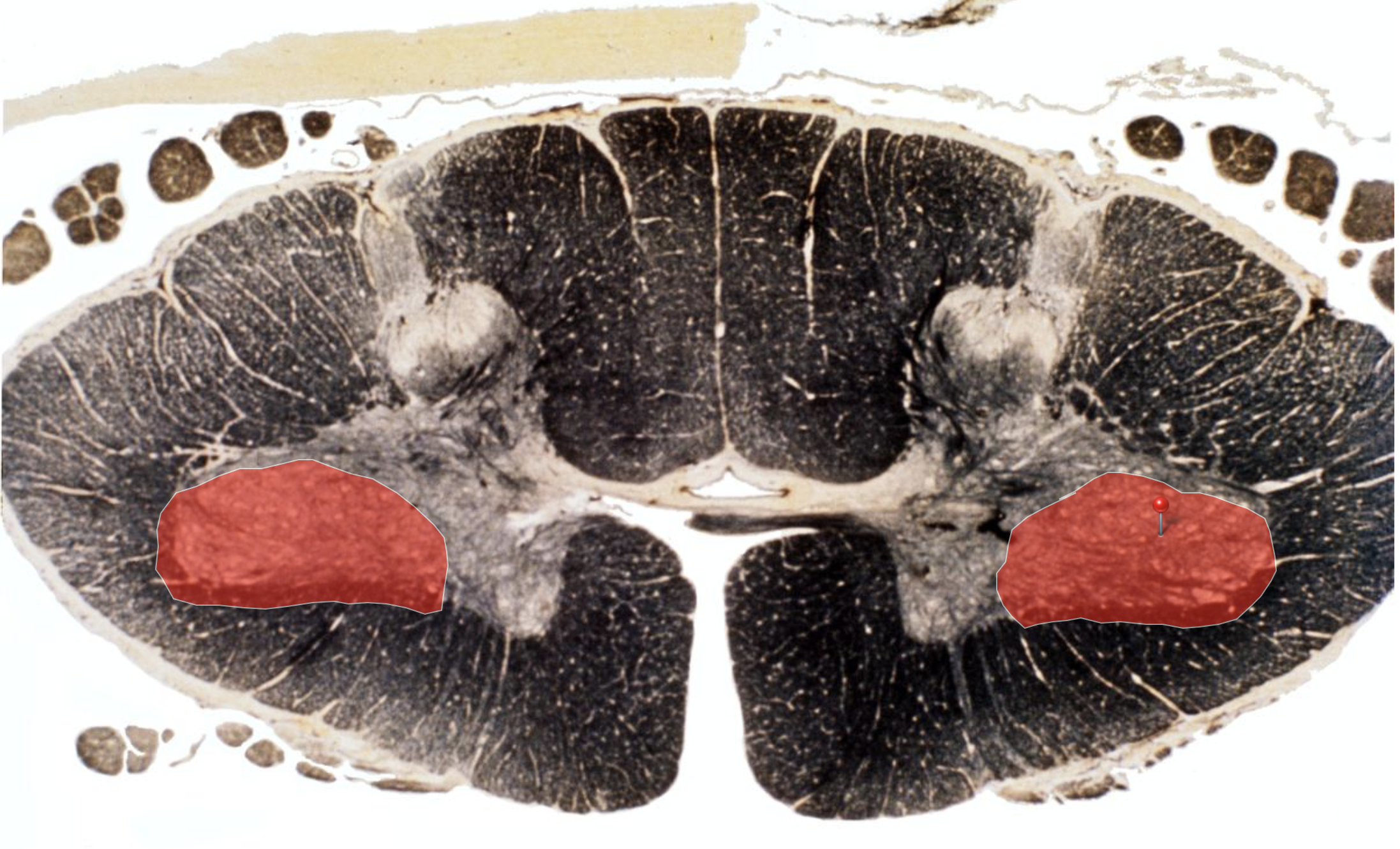 <p>Lateral Motor Column </p><p></p><p>Motor for <strong>Limb Muscles (Lateral)</strong></p><ul><li><p>Lateral to Medial = Distal to proximal muscles to the trunk</p></li><li><p>Target of Reticulospinal tract</p></li></ul><p></p>