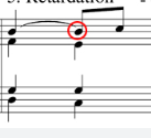 A suspension that resolves upward to a large interval (uncommon)