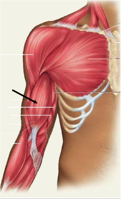 <p>Identify the indicated muscle</p>