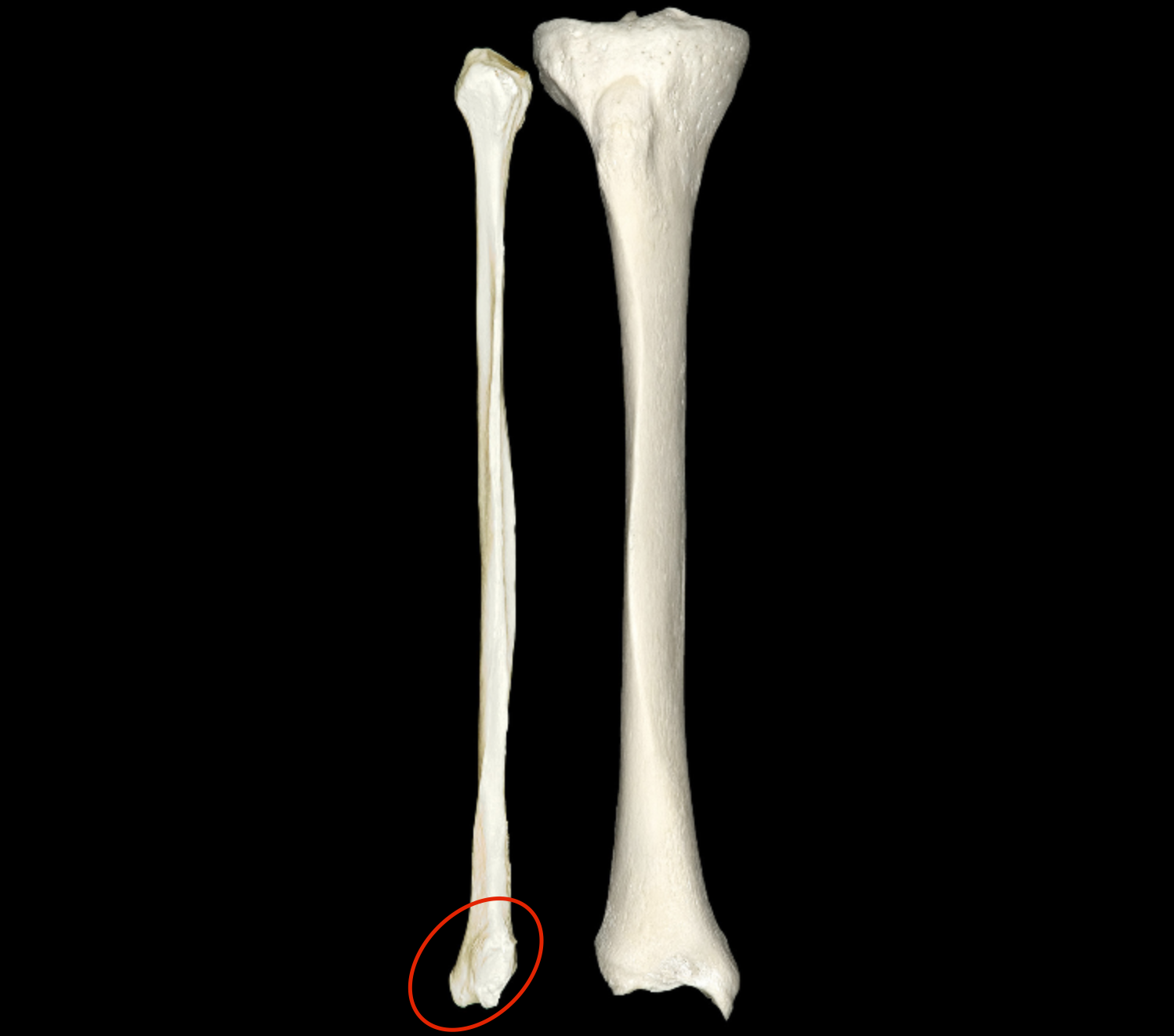 <p>oblong side of fibula </p>