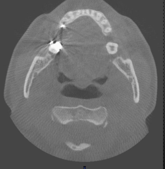 <p>which arch is this </p>