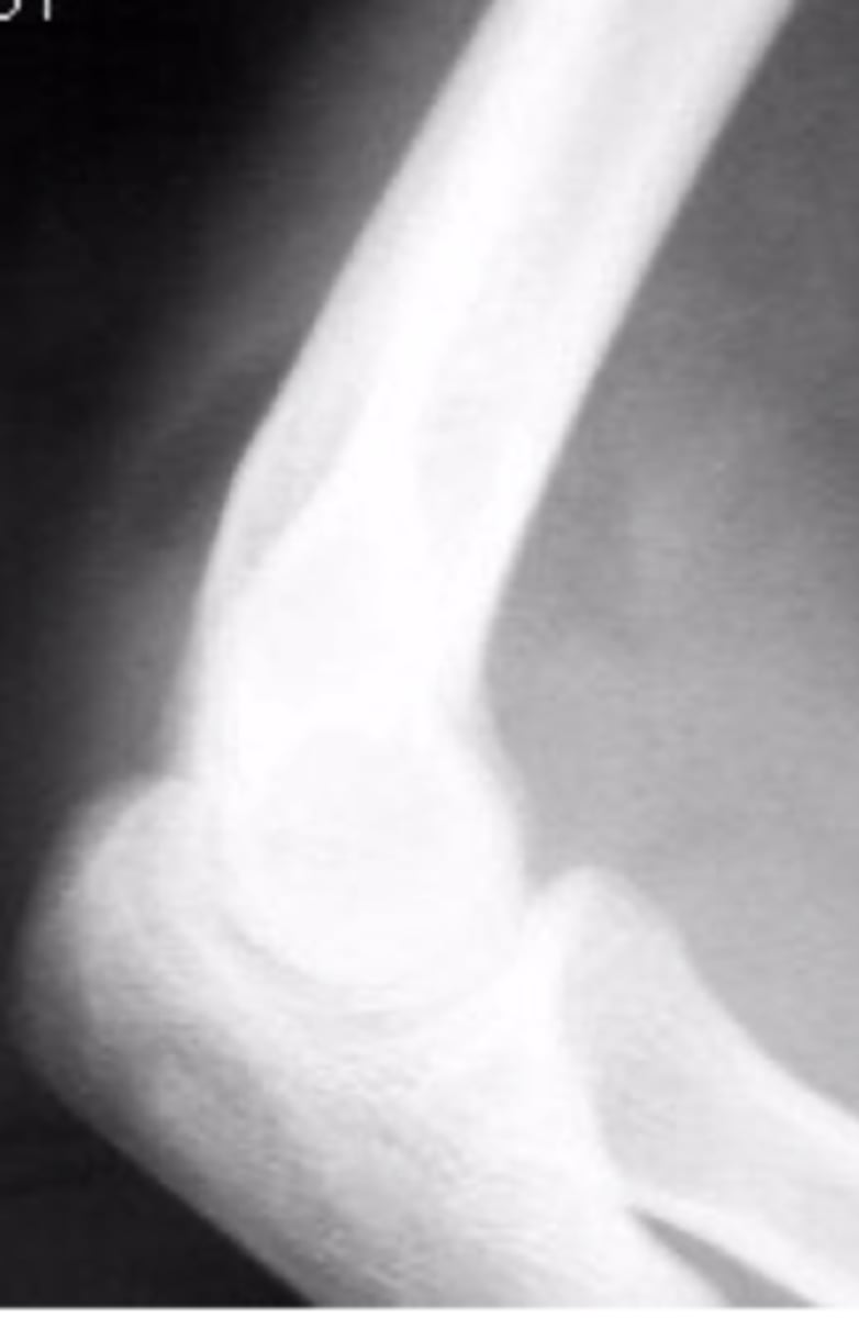 <p>What is the issue?</p>