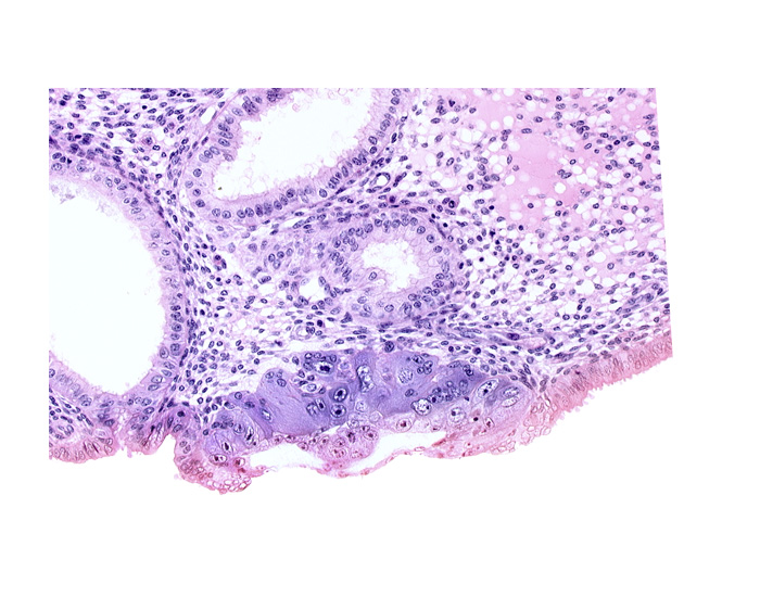 <p>Label the following:</p><ul><li><p>endometrial epithelium</p></li><li><p>endometrial gland</p></li><li><p>amniotic cavity</p></li><li><p>lumen of endometrial gland</p></li><li><p>blastocoele</p></li><li><p>syncytiotrophoblast</p></li><li><p>cytotrophoblast</p></li></ul><p></p>
