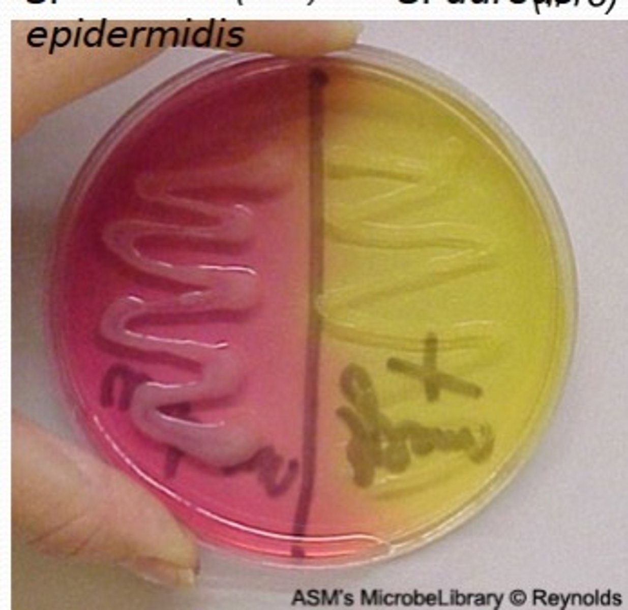 <p>Staphylococcus and mannitol fermentation (yellow = positive)</p>