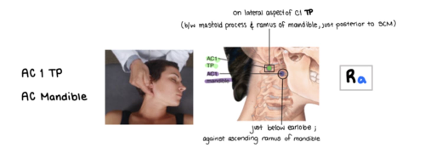 <p>Ra</p><p>pt is supine</p><p>lateral aspect of C1 transverse process b/w ramus of mandible and mastoid process</p><p>rectus capitis lateralis muscle</p>