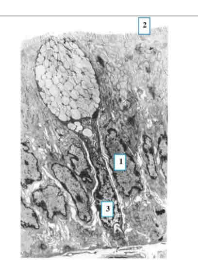 term image