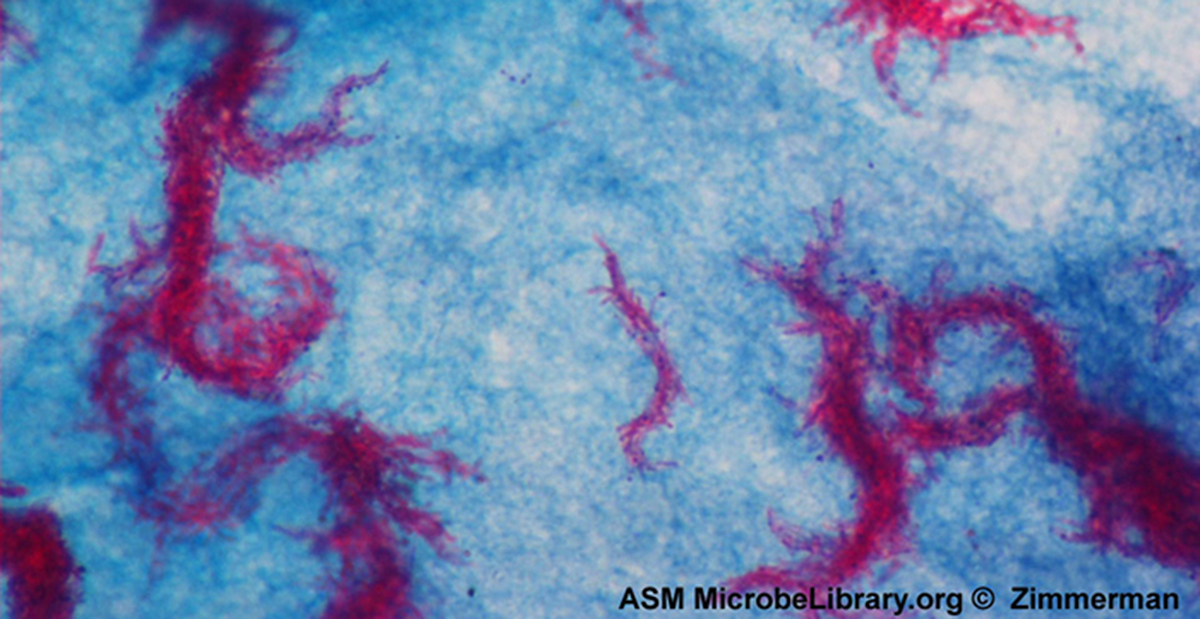 <p><strong>A:</strong> <strong>Immunofluorescence</strong> with <strong>fluorochrome-labeled antibodies</strong>.</p>