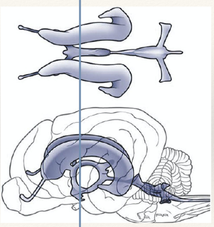 <p>which ventricles is the line passing through?</p>
