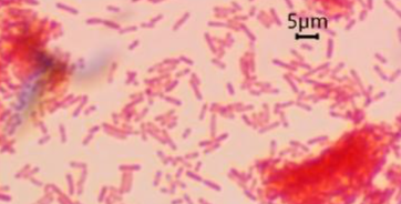 <p>2.5</p>