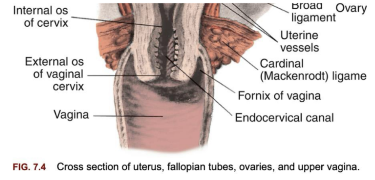 <p><span style="background-color: transparent; font-family: "Times New Roman", serif;"><em>Clinical Relevance:</em></span></p><ul><li><p><span style="background-color: transparent; font-family: "Times New Roman", serif;">Cervical dilation (widening of external os) measured in cm during labor.</span></p></li><li><p><span style="background-color: transparent; font-family: "Times New Roman", serif;">Cervix consistency & effacement (thinning) are key signs of readiness for birth.</span></p></li></ul><p></p>