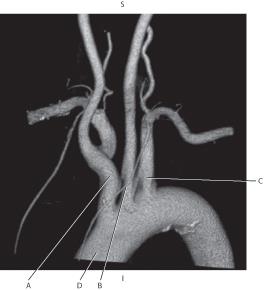 <p>Which line points to the <mark data-color="yellow">left common carotid artery?</mark></p>