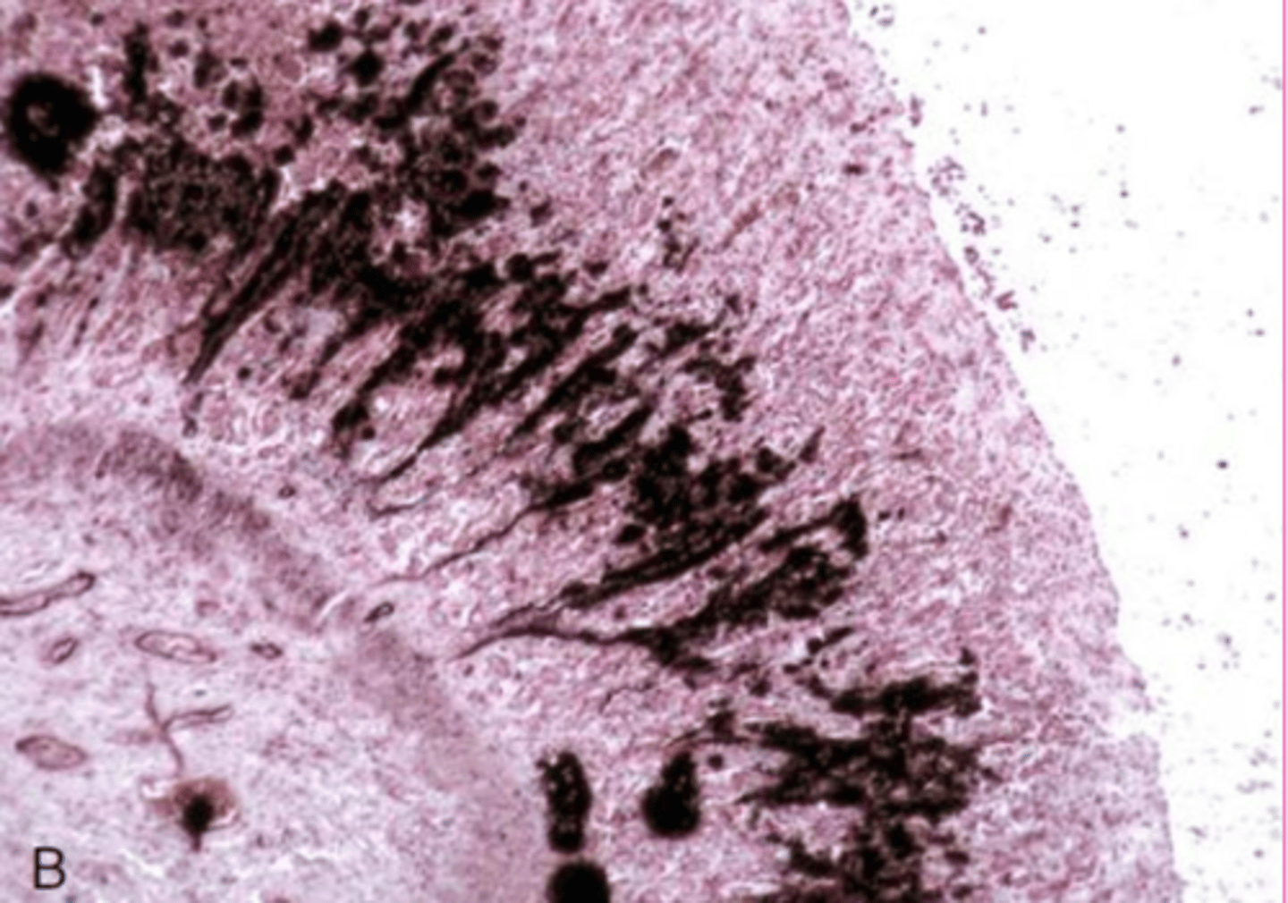 <p>this is calcification... why does it look like that?</p>