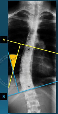 <p>Q what is the name of this measurement? and what is the average + range?</p>