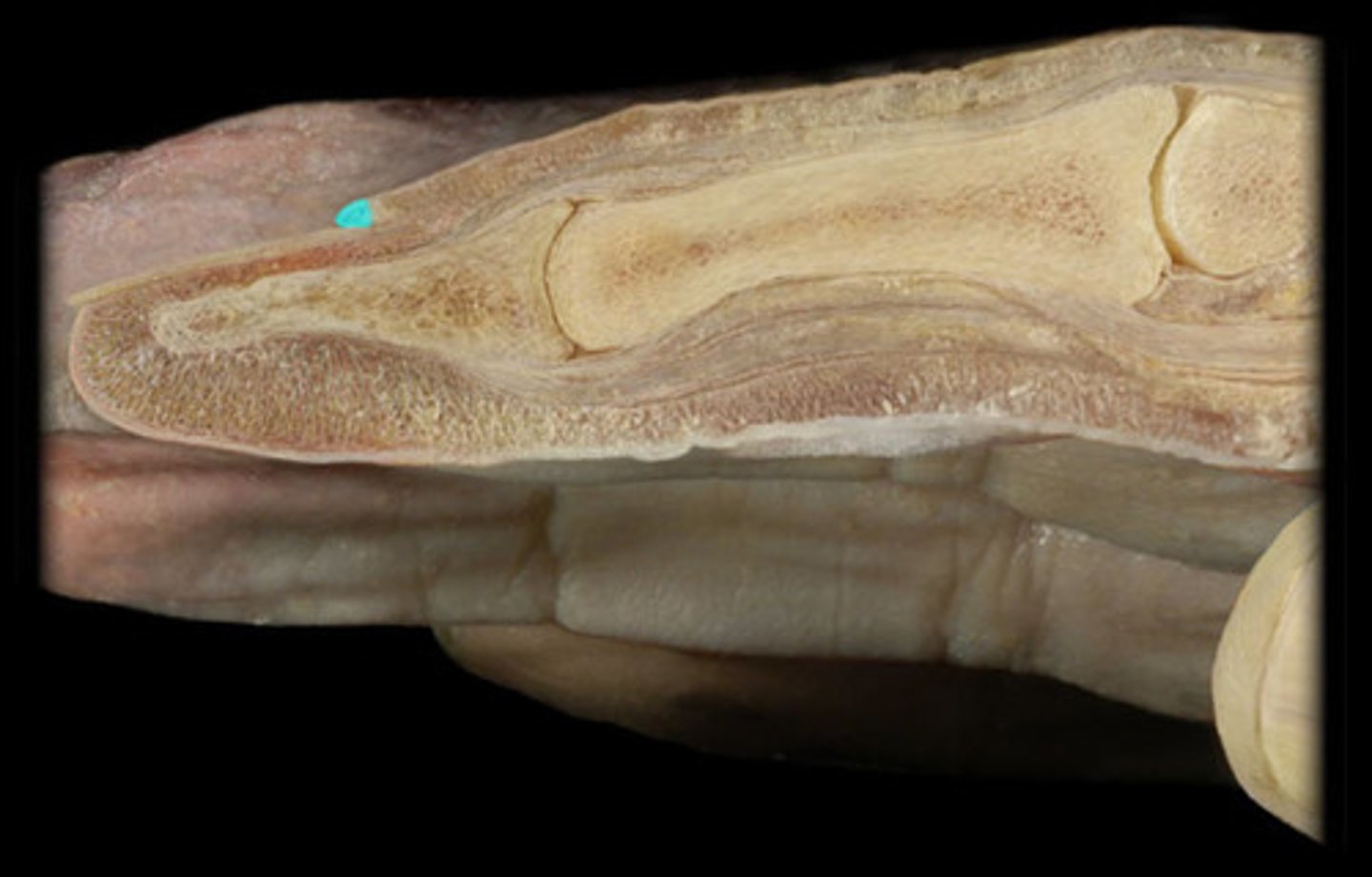 <p>- Thin layer of skin at the base of the nail, where the skin meets the nail body.</p>