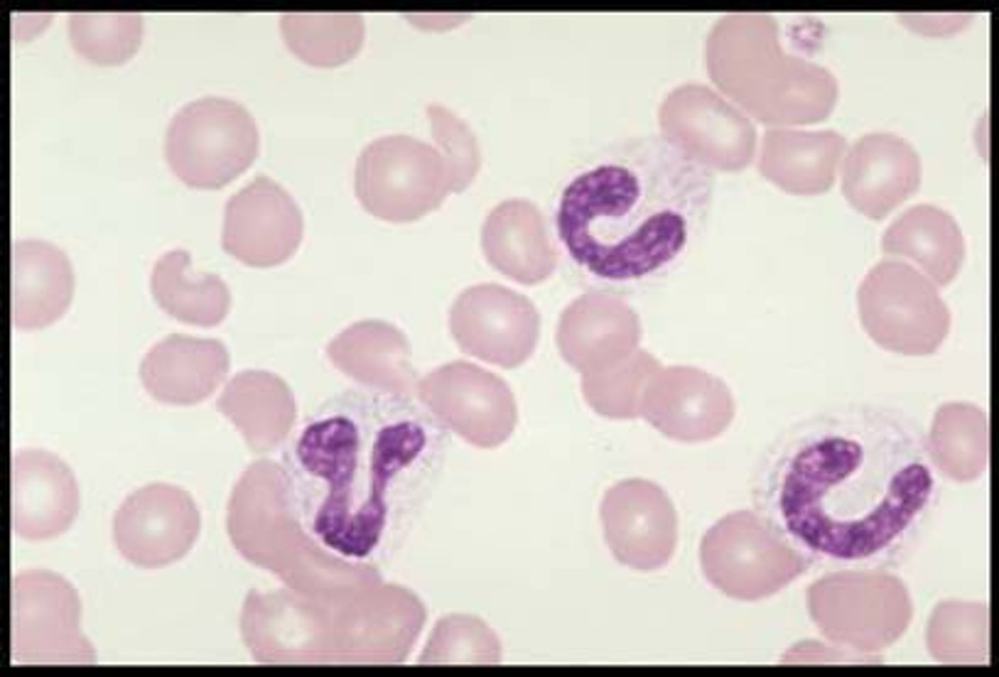 <p>immature neutrophils, unsegmented nuclei</p>