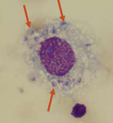 <p>1. pulmonary</p><p>2. disseminated</p>