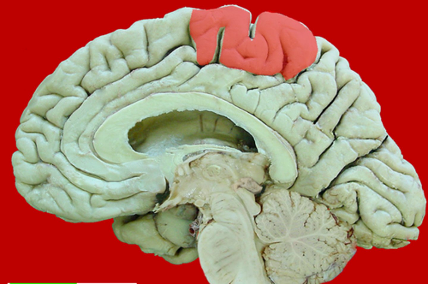 <p>medial extension of the pre/post central gyri</p>