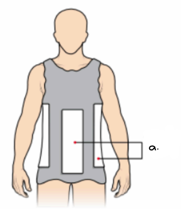 <ul><li><p>what type of cast is this? (indicate the view) </p></li><li><p>label the letter a.</p></li></ul><p></p>