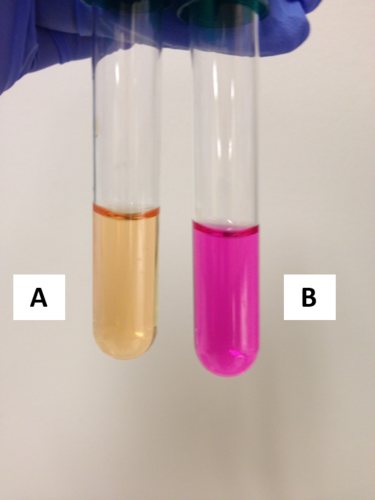 <p>Which tube is positive for urease activity?</p>