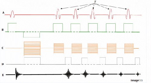 <p><span><strong>Image 73 is a diagram of which pulse sequence?</strong></span></p>