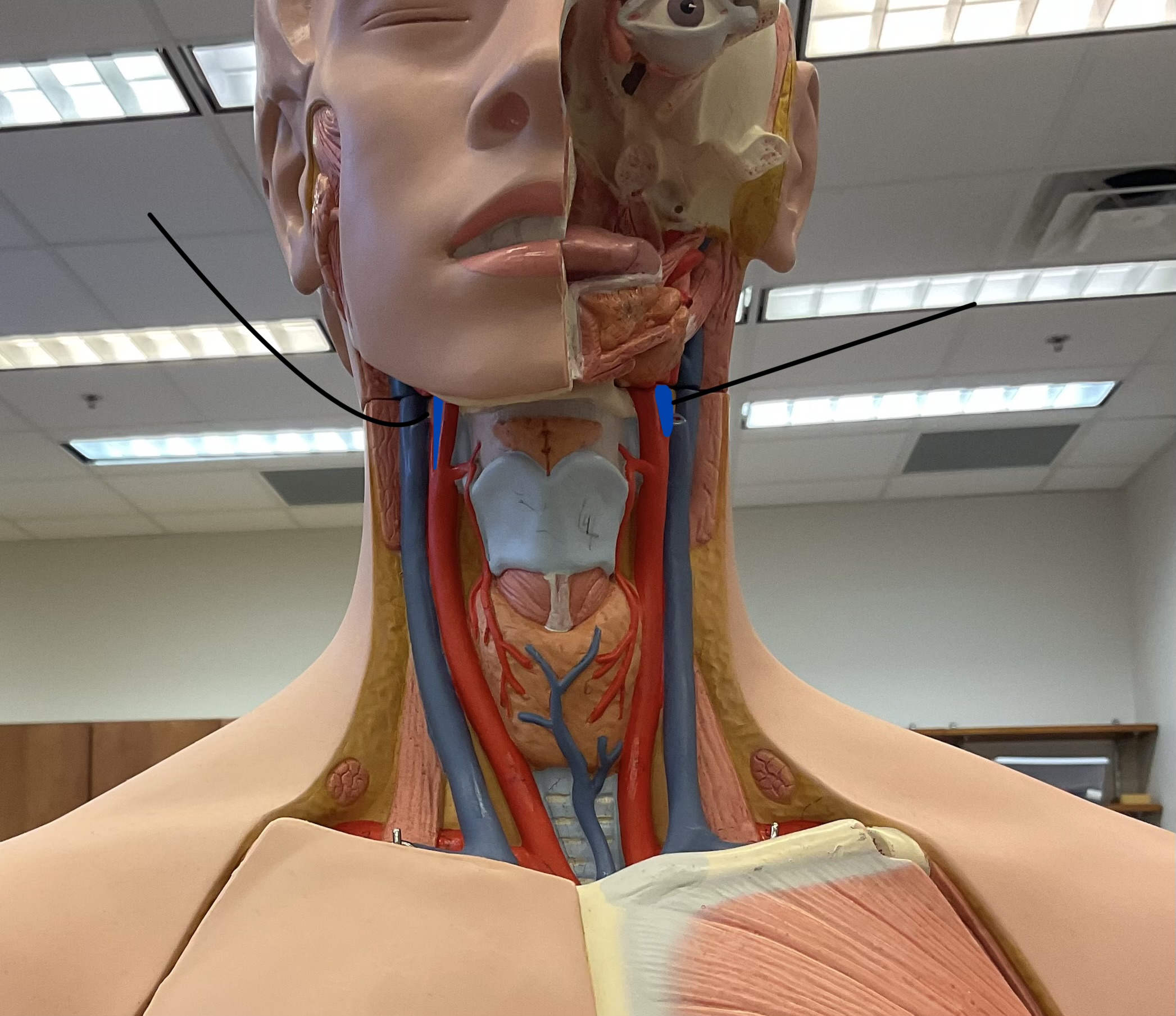 <p>Name these arteries that feeds into the face.</p>