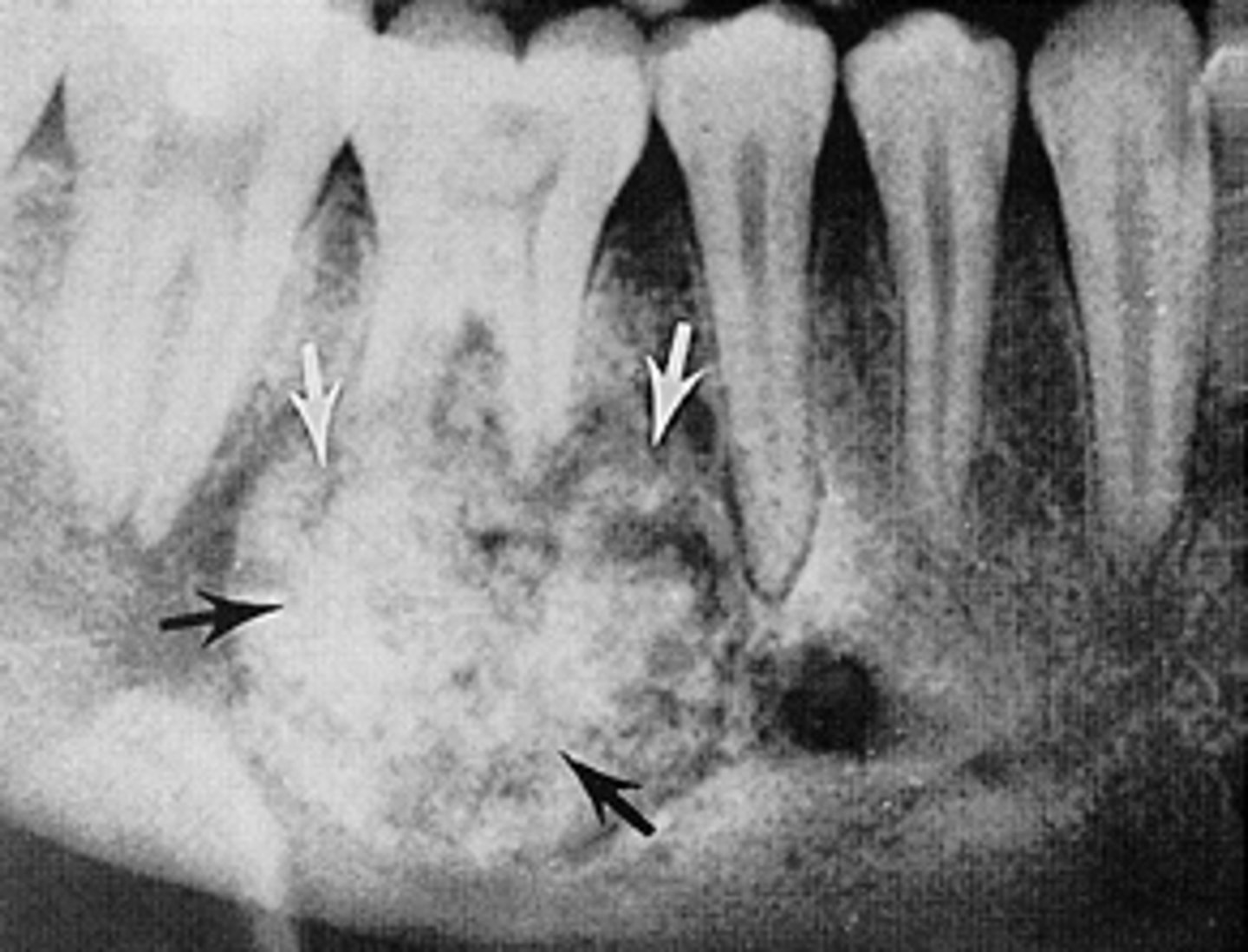 <p>ID the pathology:</p>