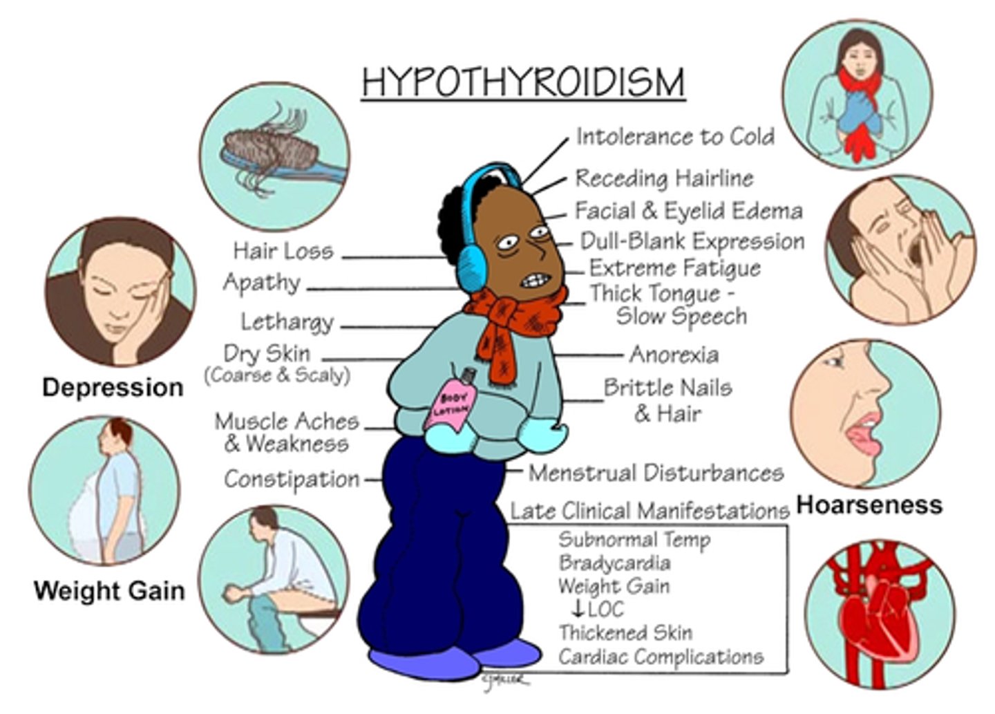 <p>Low production of T3 and T4 =></p><p>1: Slow heart rate (pulse)</p><p>2: Weight gain</p><p>3: Feeling constantly cold</p><p>4: Low appetite</p>