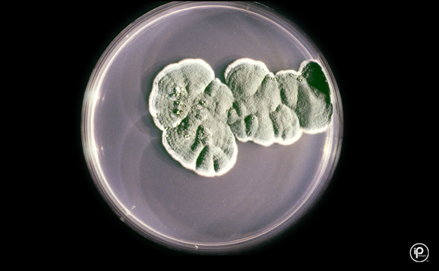 <p><em>Penicillium spp.</em></p>