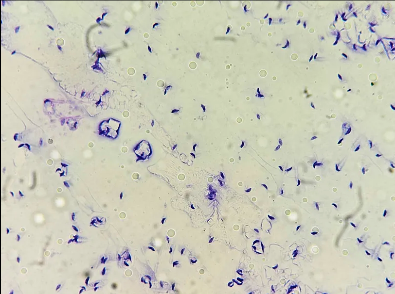 <p><span data-name="microscope" data-type="emoji">🔬</span><span data-name="petri_dish" data-type="emoji">🧫</span><strong><span> </span>Na podstawie zdjęcia preparatu:</strong></p><p></p><ul><li><p><span>📖 </span>rozpoznaj gatunek pasożyta;</p></li></ul><p></p><ul><li><p><span>♻ </span>rozpoznaj wszystkie formy rozwojowe;</p></li></ul><p></p><ul><li><p><span>🦠 </span>wskaż organelle i cechy charakterystyczne dla danego gatunku;</p></li></ul><p></p><ul><li><p><span>😷 </span>nazwij chorobę, którą pasożyt wywołuje.</p></li></ul><p></p>
