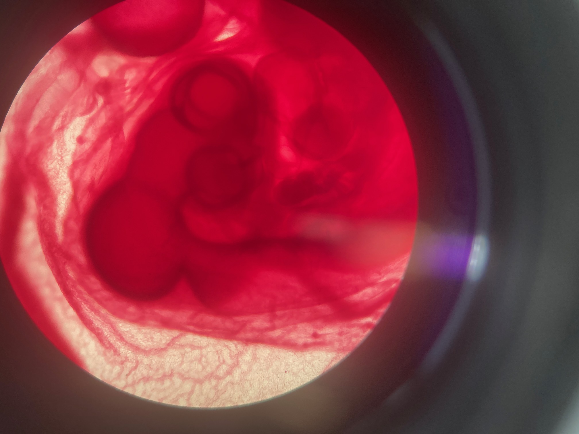 <p>Chicken embryo</p><ol><li><p><span>Epiblast cells</span></p></li><li><p><span>Hypoblast cells</span></p></li><li><p><span>Mesoderm cells</span></p></li><li><p><span>Endoderm cells</span></p></li><li><p><span>Ectoderm cells</span></p></li><li><p><span>Neural crest cells</span></p></li><li><p><span>Extraembryonic cells</span></p></li></ol>