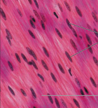<p>What type of muscle tissue is this?</p>