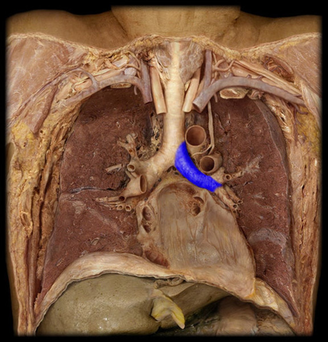 <p>Label the Segment</p>