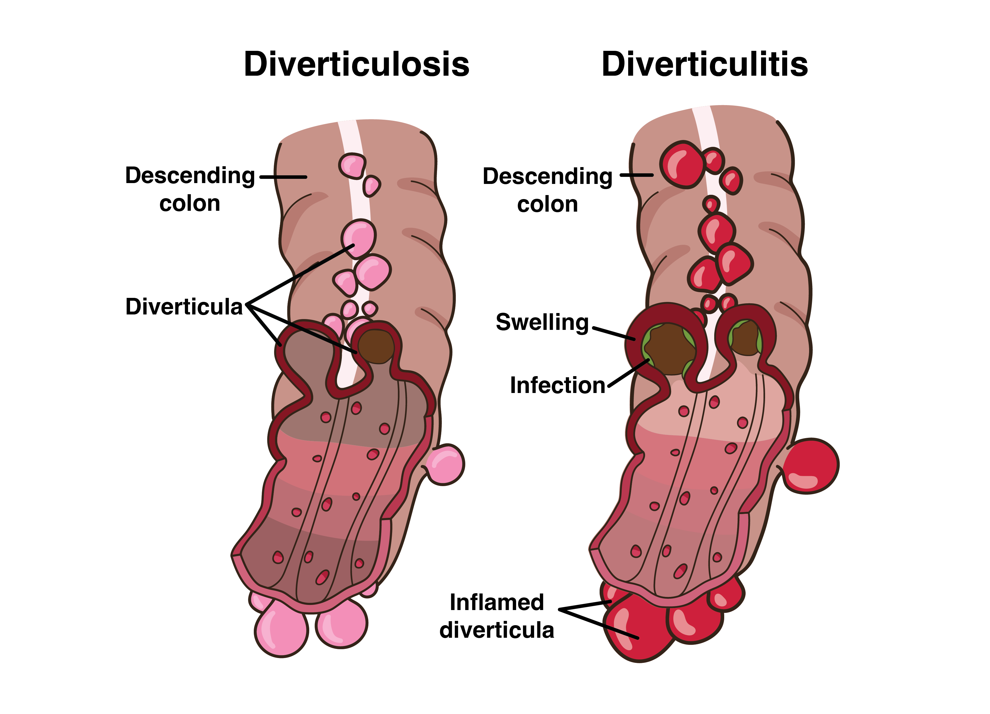 <p>Explain the two conditions</p>