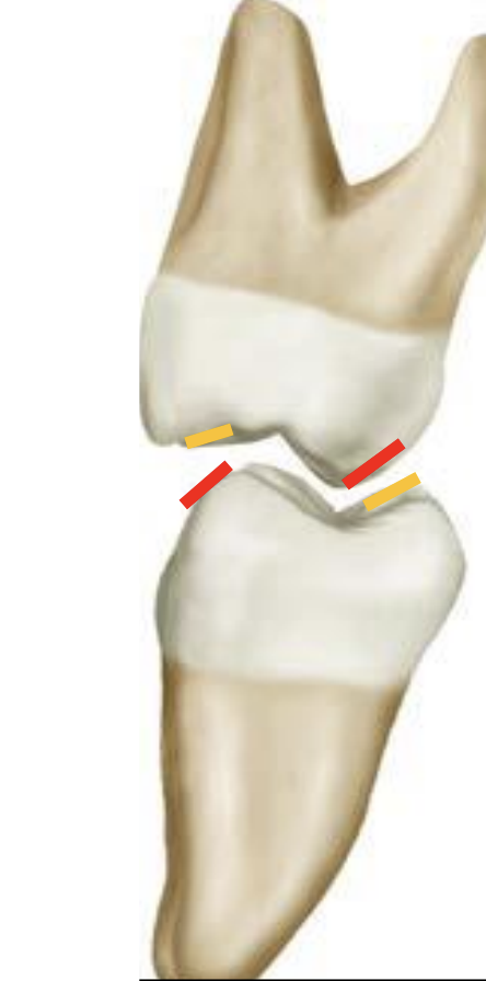 <p>1 mm area on <strong>outer aspect of centric cusps <mark data-color="red" style="background-color: red; color: inherit">(red)</mark></strong>, functions against inner incline of non-centric cusp</p><p></p><p>Assists in shearing of food during mastication</p>