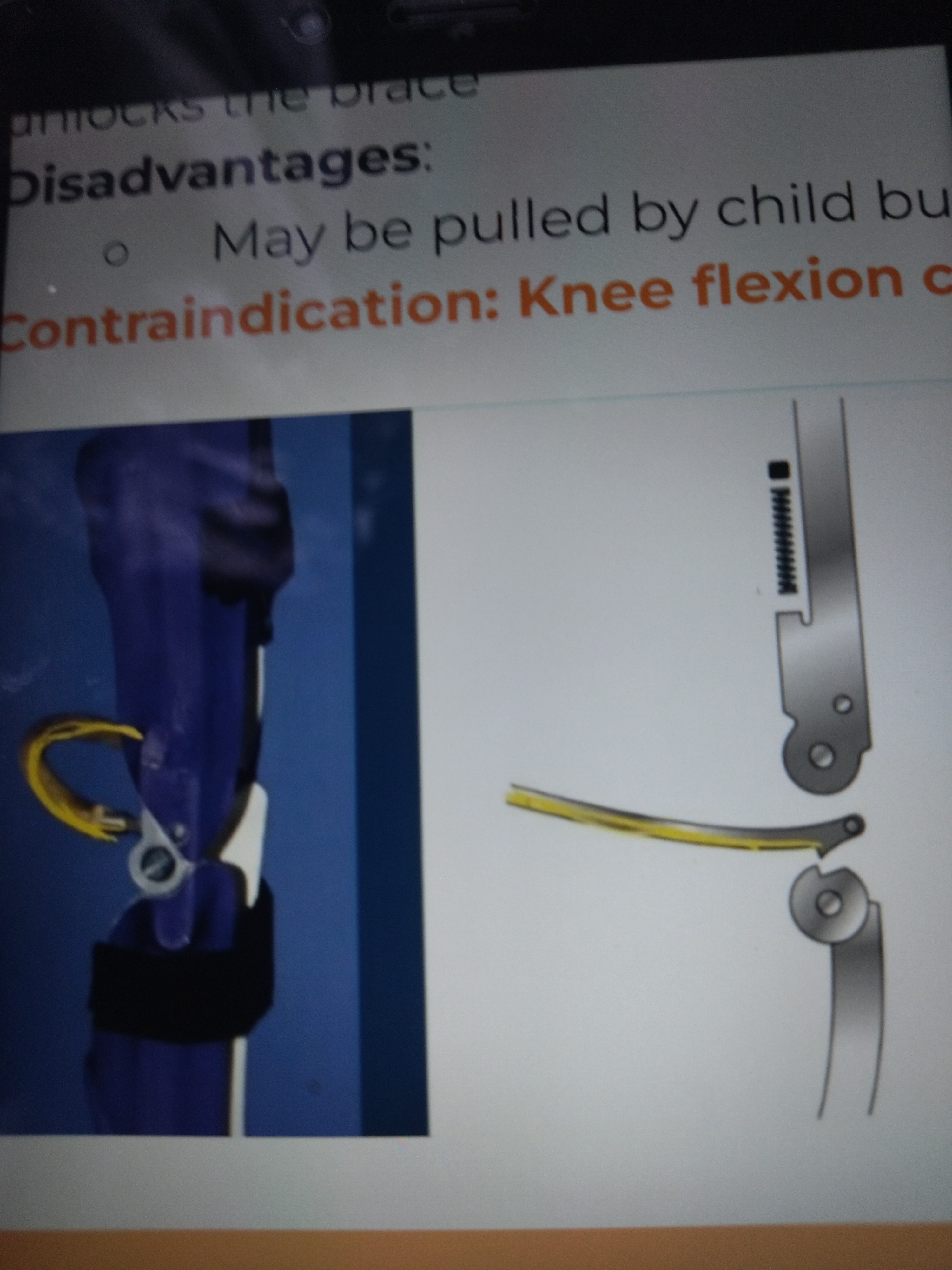 * Aka Pawl/Bail/Swiss/French/Schweitzer Lock
* Provides simultaneous locking of both uprights and pulling of posterior bill that unlocks the brace