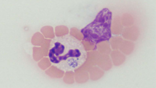 <p>what spreads <span style="color: rgb(254, 254, 254);"><span>Anaplasma spp.; A. phagocytophilum/A. platys</span></span></p>