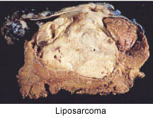<p><span><span>Identify the pathology definition for the following illustration.</span></span><br></p>