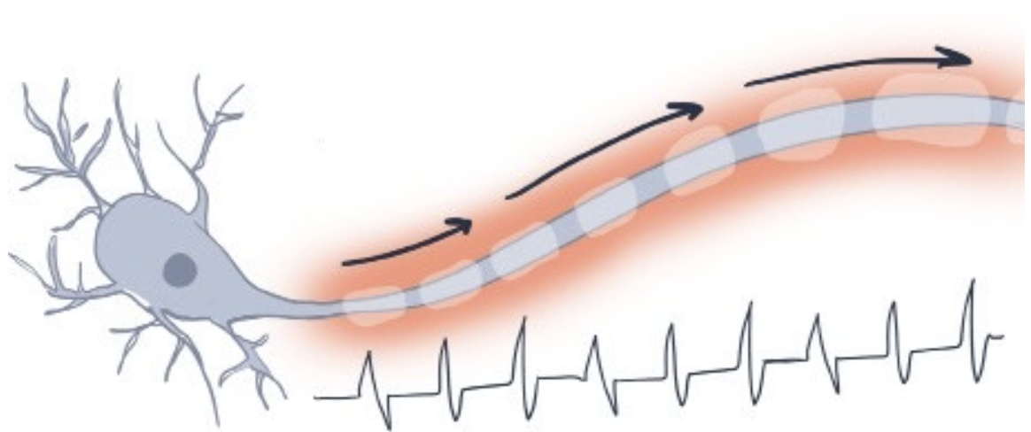 <p>excitatory potential is produced that exceeds threshold of excitation and produces an AP that continues undiminished down axon (conduction)</p>