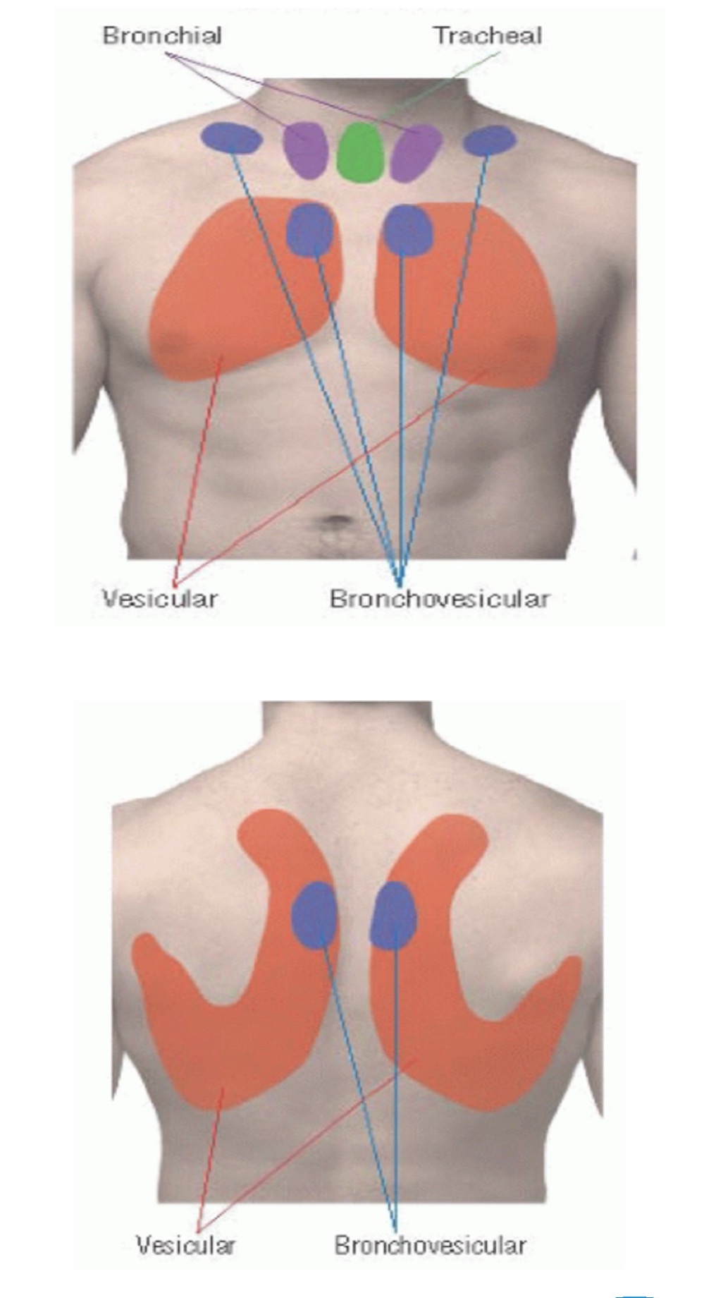 <ul><li><p>Duration: expiratory are longer</p></li><li><p>Intensity: loud</p></li><li><p>Pitch of expiratory: high</p></li><li><p>Location: either side of manubrium</p></li></ul><p></p>