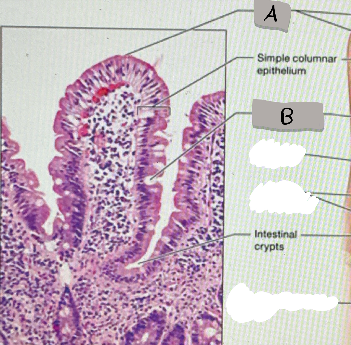 <p>what does label B represent ?</p>