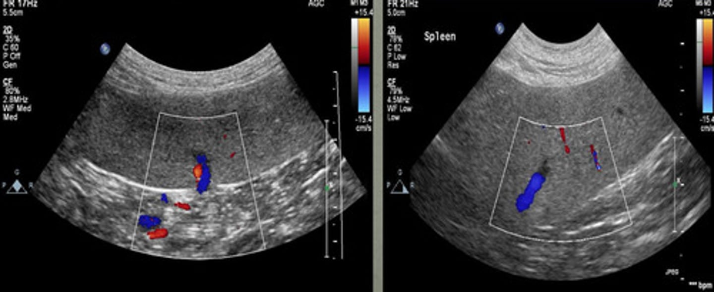 <p>what type of tool is being used in this ultrasound to see the different vessels?</p>