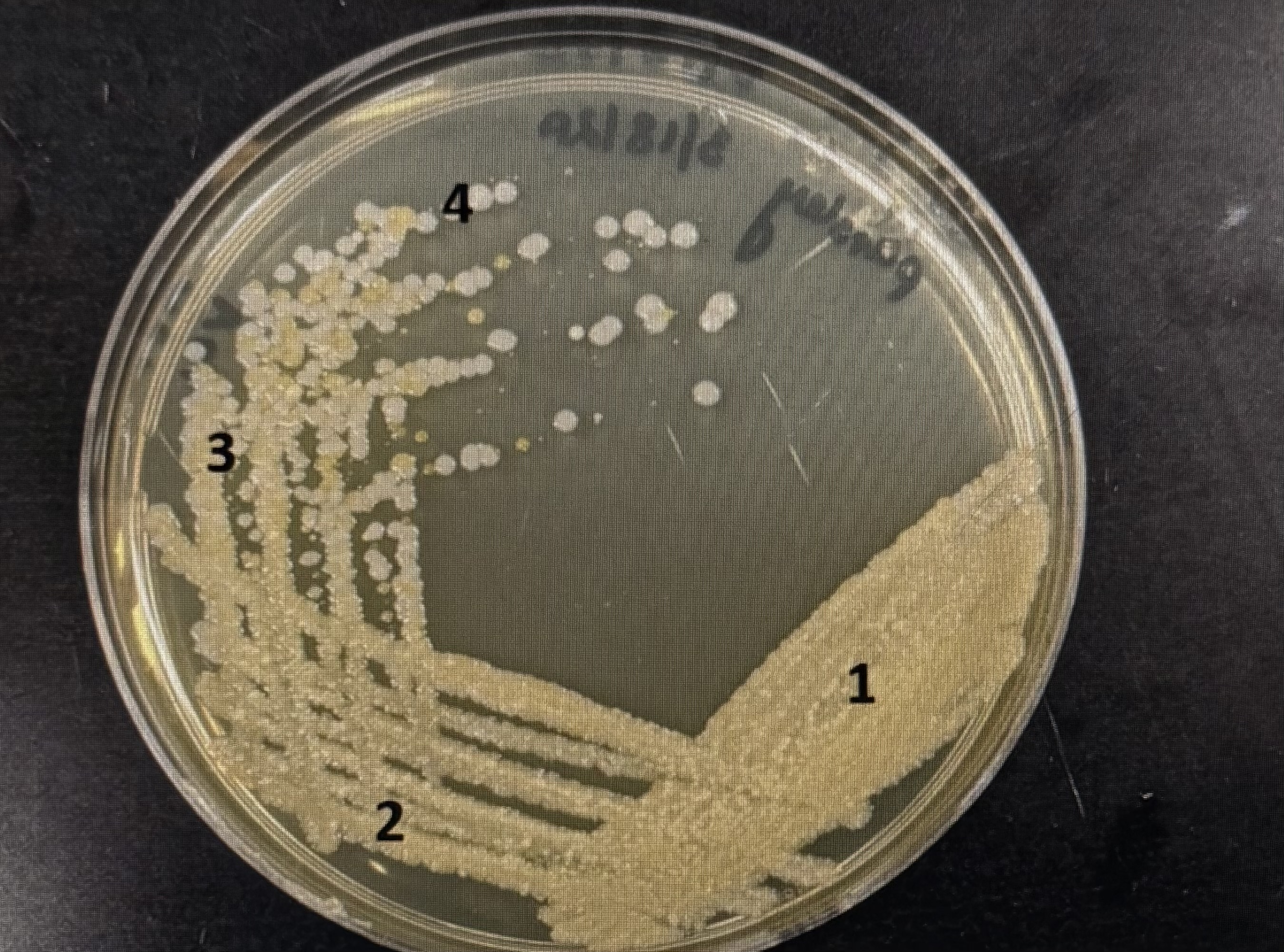 <p><span><span>What was the purpose of picking samples from the quadrant 4?</span></span></p><p>individual, well isolated colonies in quadrant 4 will generate a pure culture</p><p>individual, well isolated colonies in quadrant 4 will generate a mixed culture</p><p>different bacteria are present in quadrants 4 and 1</p><p>quadrant 4 looks prettier than 1</p>