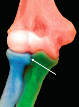 <p>Name joint </p>