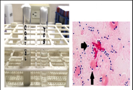 <p>What is the composition of the special structure that is demonstrated by this organism?</p>